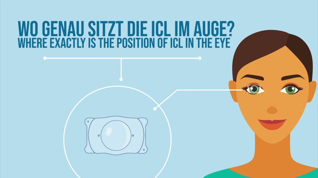 Visian ICL - Implantierbare Kontaktlinsen | MUNICH EYE