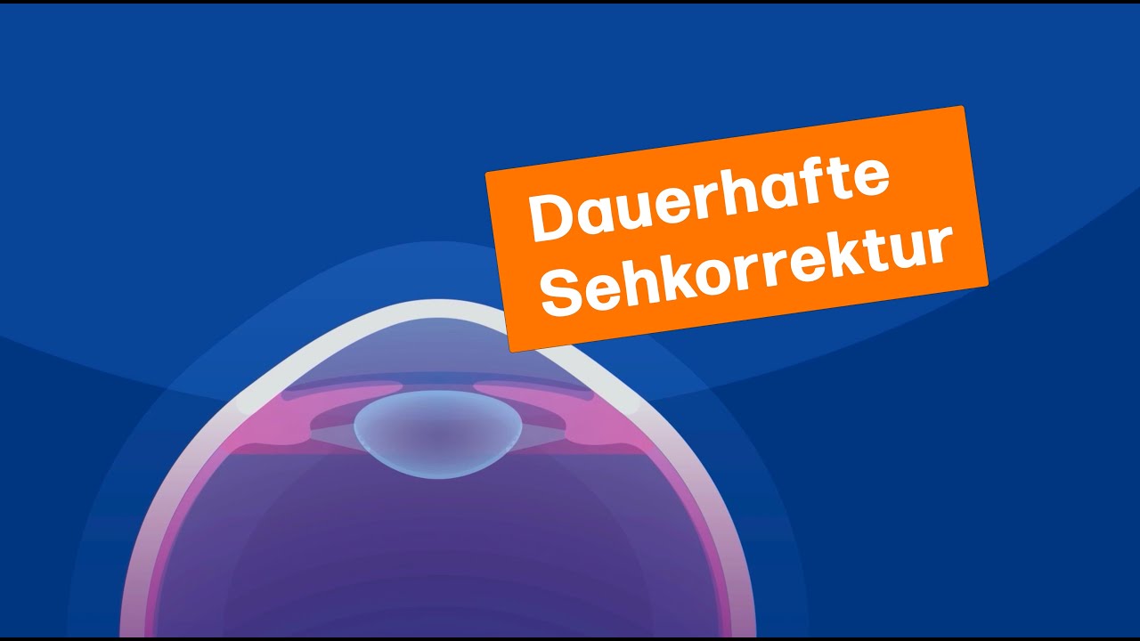 Dauerhafte Sehkorrektur im Überblick | MUNICH EYE