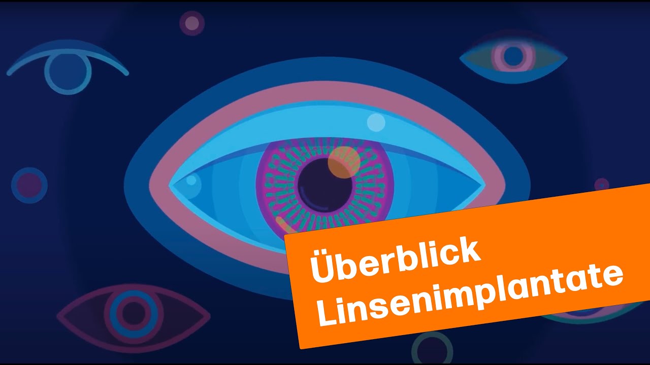 Überblick Linsenimplantate | MUNICH EYE