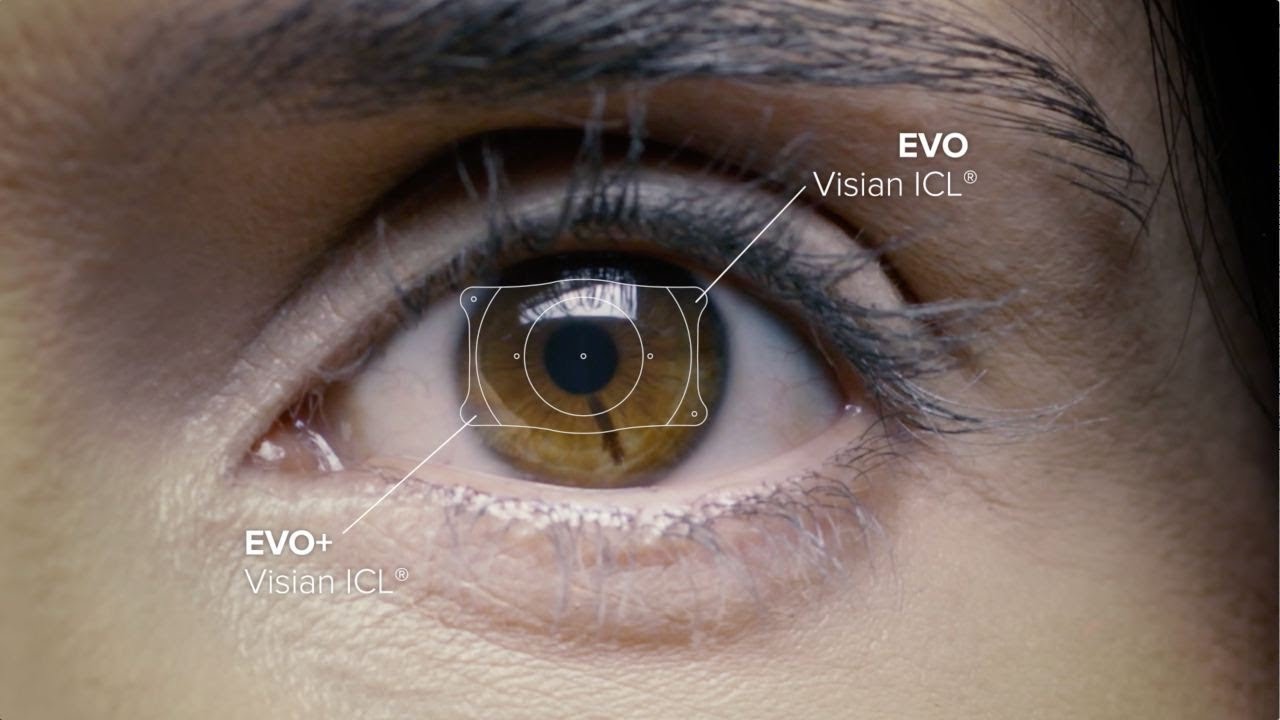 EVO Visian ICL - STAAR Surgical Corporate Video