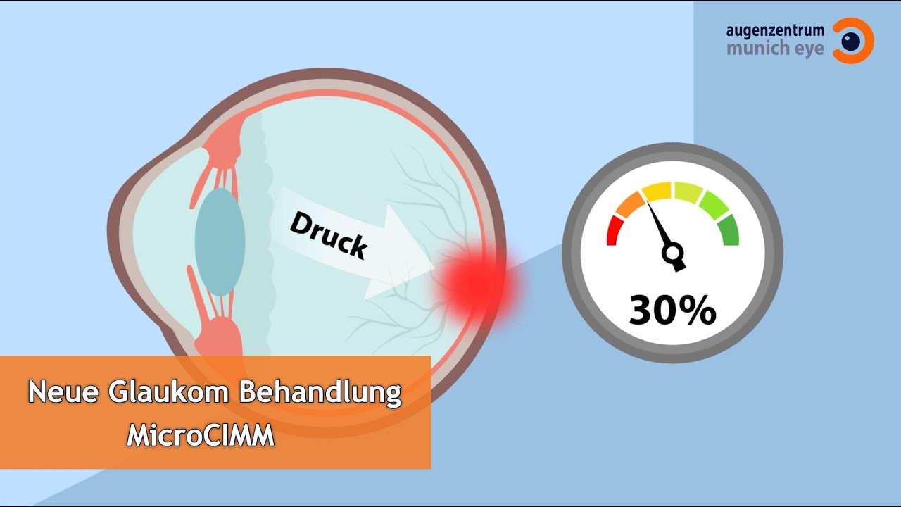 Lasertherapie bei Glaukom (MicroCIMM) | MUNICH EYE