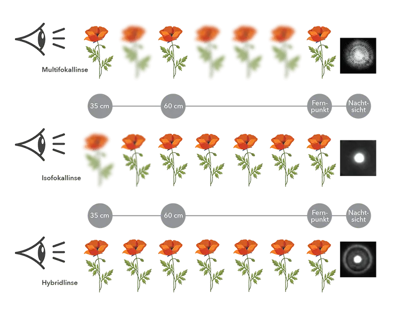 Diagramm mit zwei Reihen stilisierter Mohnblumen zwischen unscharf und scharf: Oben unter „Multifokallinse (Trifokale Ausführung)“ wechseln drei fixe scharfe Abbildungen der Blume bei 40 cm, 60 cm und im Fernbereich mit dazwischenliegenden unscharfen Bildern. Unten unter „Isofokallinse (EDOF für Ferne)“ ist die Blume in allen Abständen gleichermaßen scharf abgebildet, symbolisch für den fließenden Übergang.