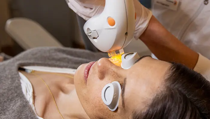 Patientin wird mit der IPL Lichttherapie gegen Trockene Augen behandelt.