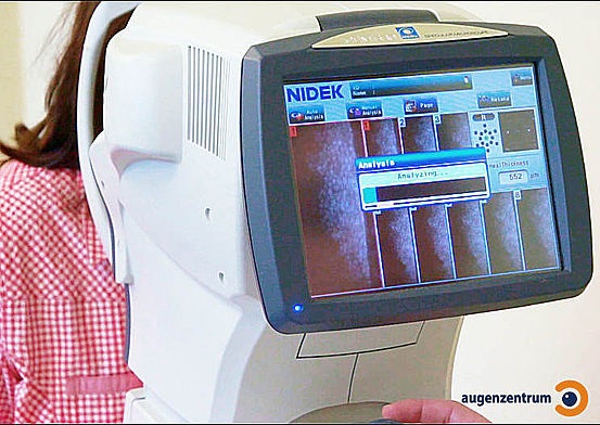 Endothelmikroskop beim Messen - Mit einer hochpräzisen, computergestützten Spezialkamera wird die Anzahl der Endothelzellen der Hornhaut analysiert.