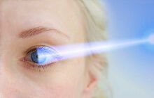 Trans PRK Augenlasern Bei Trans-PRK arbeitet der Laser auf der obersten Hornhautschicht. Dieser Vorgang ist schmerzfrei und das Auge wird dabei nicht berührt.
