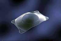 Staar Evo Visian ICL implantierbare Kontaktlinse