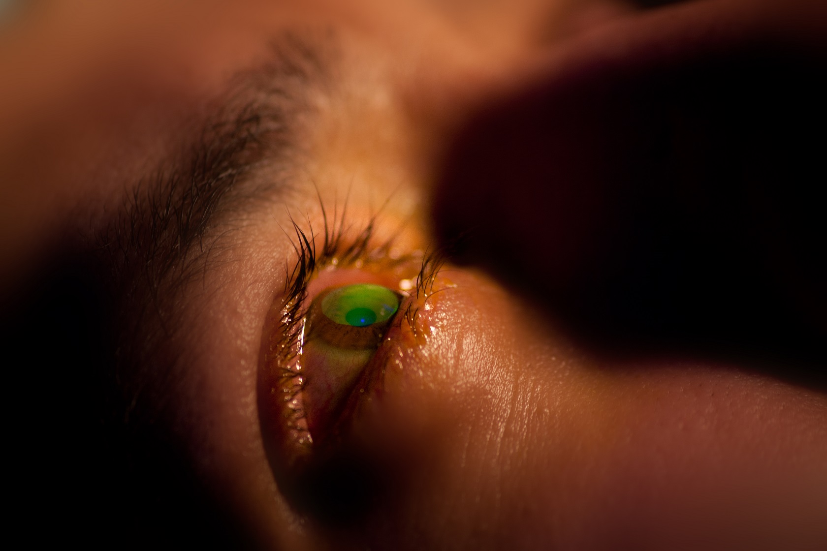 Auge wird bei Crosslinking mit UV-Licht bestrahlt