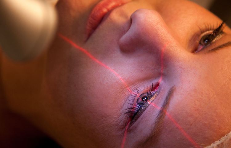 LASIK Operation - Augenlasern im OP