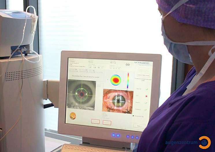 Der Excimer Laser während der Korrektur der Hornhaut bei der Trans-PRK- Laserbehandlung.